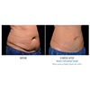 adbomen 8 weeks female, your results may vary