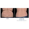flank 12 weeks female, your results may vary