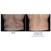 flank 15 weeks male, your results may vary