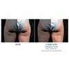 outer thighs 16 weeks female, your results may vary