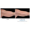 underarm 27 weeks female, your results may vary
