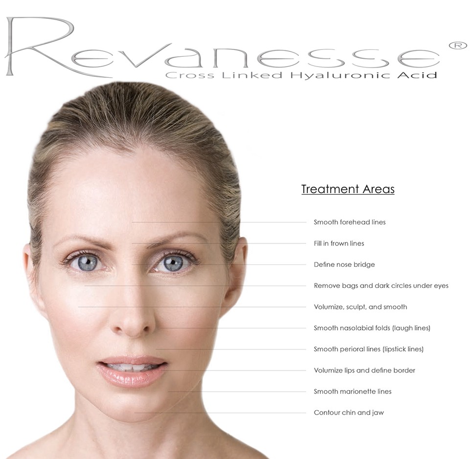 woman's face showing various treatment areas