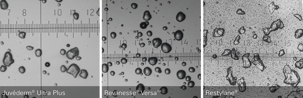 comparación de rellenos dérmicos con Versa que muestra claramente partículas más esféricas.