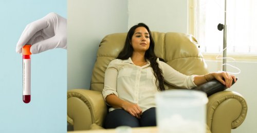 vial de sangre; paciente recibiendo terapia IV.