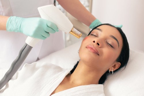 woman receiving laser treatment on face.